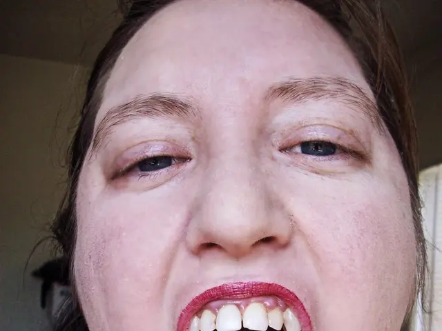 Achieving fuller lips without the use of fillers for a more organic appearance: a guide