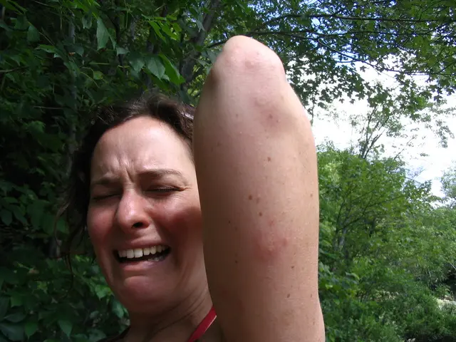 Internet's Favorite TikTok Video: Experts Weigh In on Its Potential Impact on Mental Health