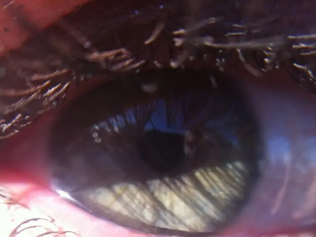 Method for Gaining Longer Eyelashes (Proven Effective)